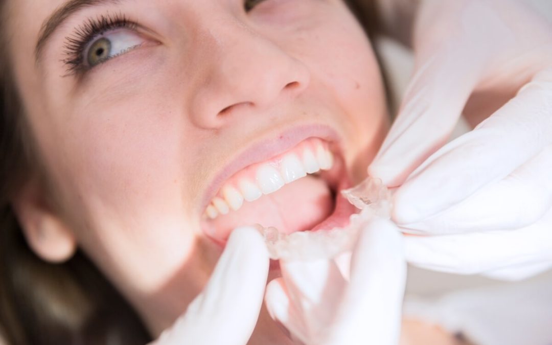 El paso a paso de tu estudio de ortodoncia en Toledo